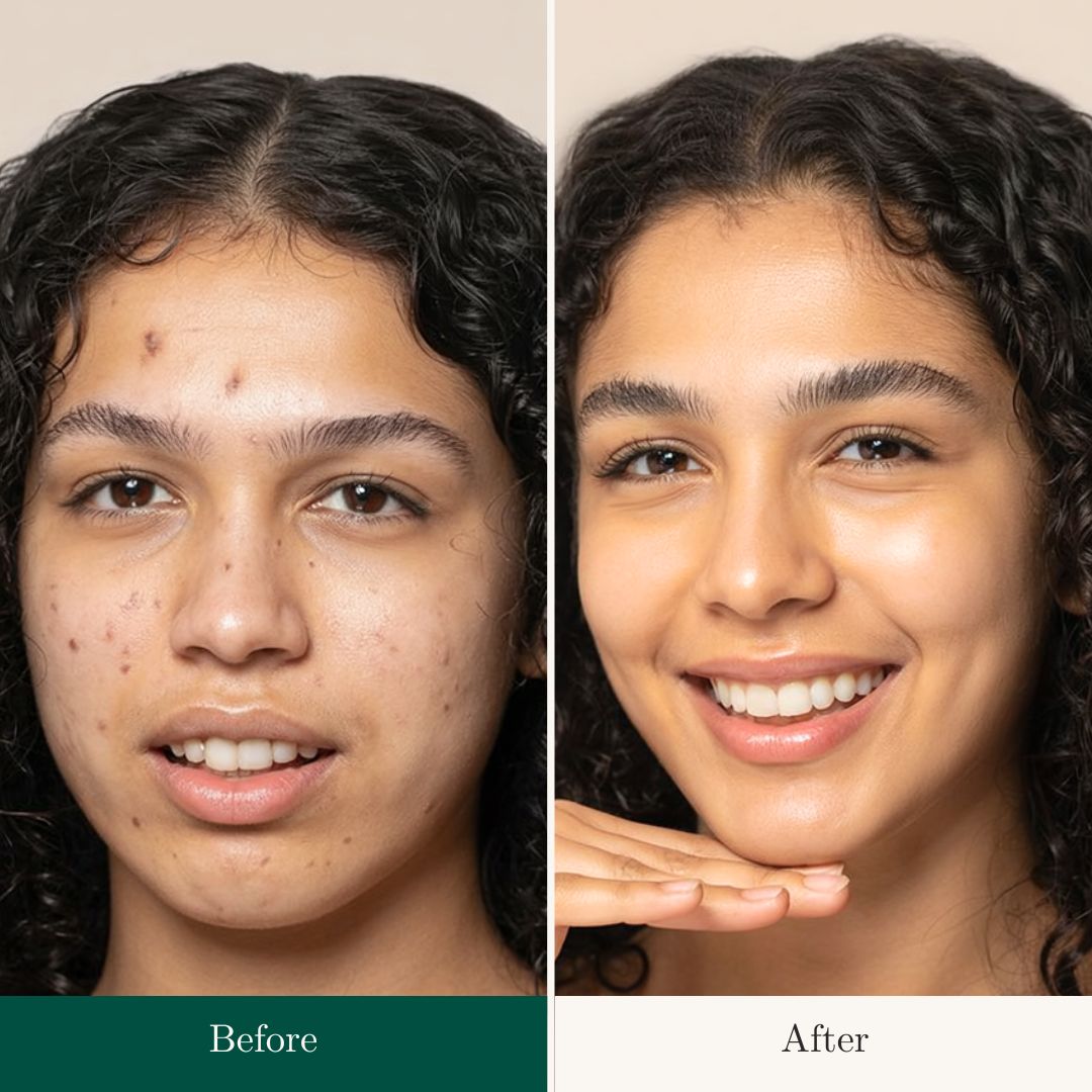Before After 23